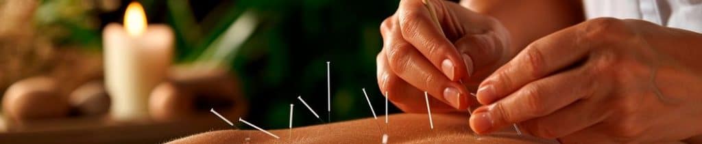 Cómo ser acupunturista en 2025: los requisitos y estudios Cómo ser acupunturista en 2025: los requisitos y estudios
