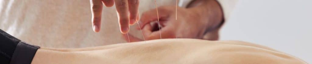 Acupuntor/a: qué es y qué hace este profesional Acupuntor/a: qué es y qué hace este profesional